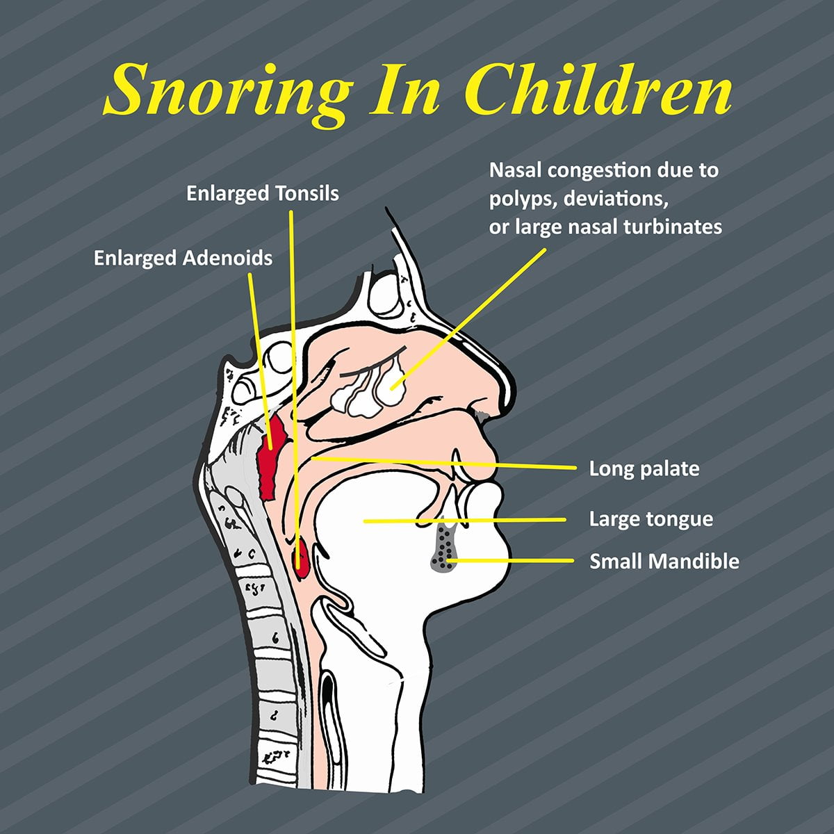 Constant Snoring